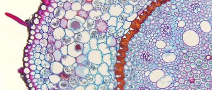 Lenticelas (vistas en microscopio)